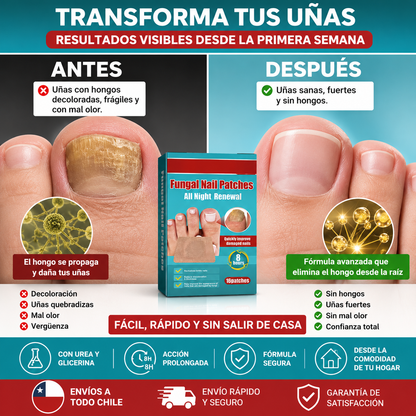 Parches Para Uñas Antihongos!!! Promo 16Unidades!!!